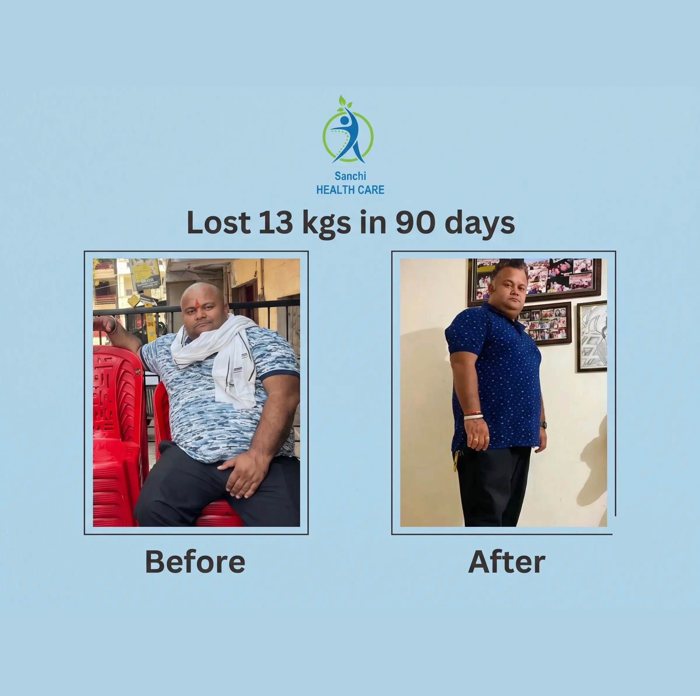 Before and after photos of a client who lost 13 kgs in 90 days on the Sanchi Nutrition & Wellness program